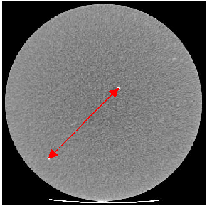Рис. 20.  Изображение слоя с парой точечных объектов для проверки линейного расстояния фантома CT ACR 46419