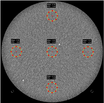 Рис. 24. Изображение слоя фантома CT ACR 464, отмечены области интереса для оценки уровня шума и однородности поля, адаптировано из [APM-223]23