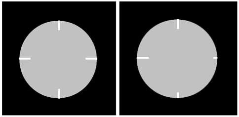 Рис. 7. Схема изображений элементов позиционирования фантома PH-9 для случаев точного и неточное позиционирования6